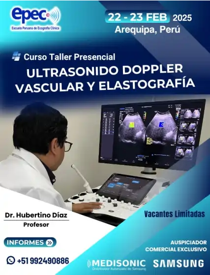 ULTRASONIDO DOPPLER VASCULAR ELASTOGRAFÍA